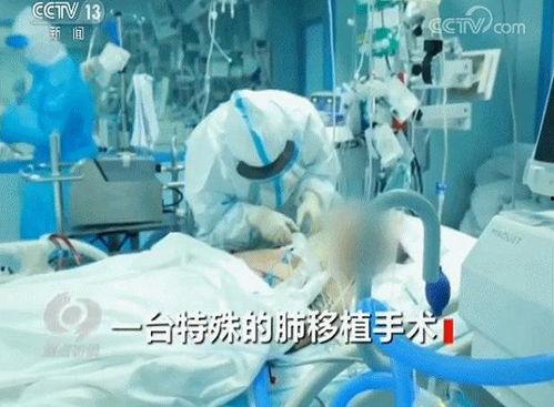 国产人工肺视频,生命守护者的创新篇章